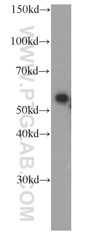 Western Blot (WB) analysis of HepG2 cells using Fetuin-A Monoclonal antibody (66094-1-Ig)