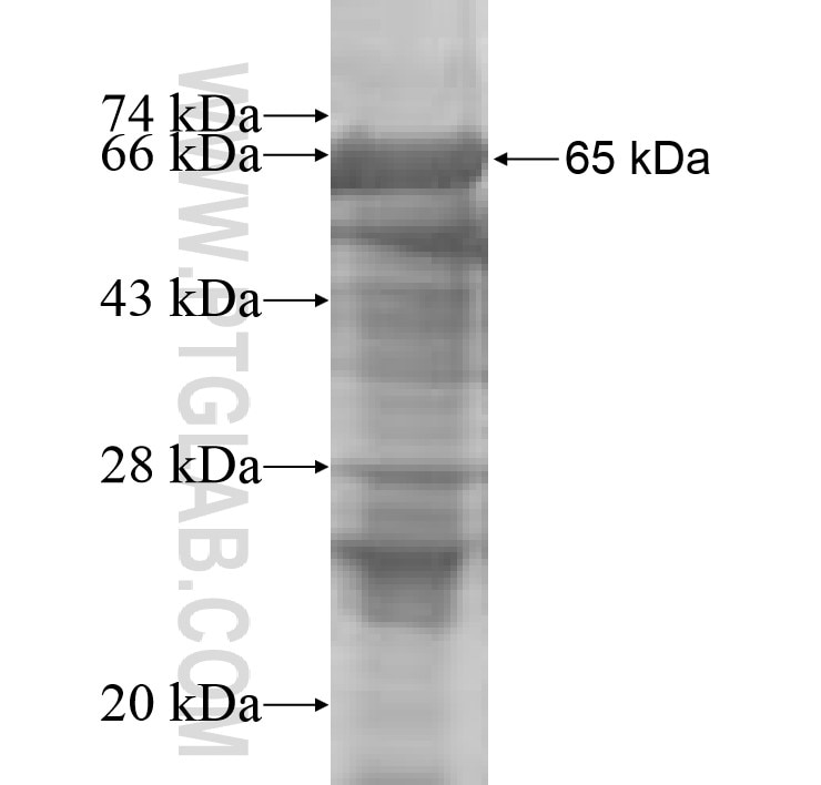 AHSG fusion protein Ag9853 SDS-PAGE