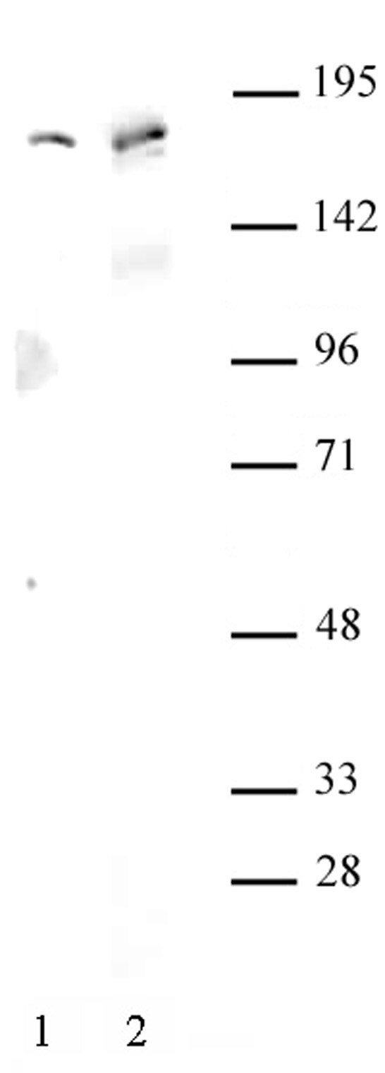 AIB1 antibody (pAb) tested by Western blot. Detection of AIB1 by Western blot. Lane 1: HeLa whole-cell extract (30 ug). Lane 2: Whole cell extract (30 ug) of MCF-7 cells. Both probed with AIB1 antibody at a 1:500 dilution. AIB1 antibody (pAb) tested by Western blot. Detection of AIB1 by Western blot. Lane 1: HeLa whole-cell extract (30 ug). Lane 2: Whole cell extract (30 ug) of MCF-7 cells. Both probed with AIB1 antibody at a 1:500 dilution.