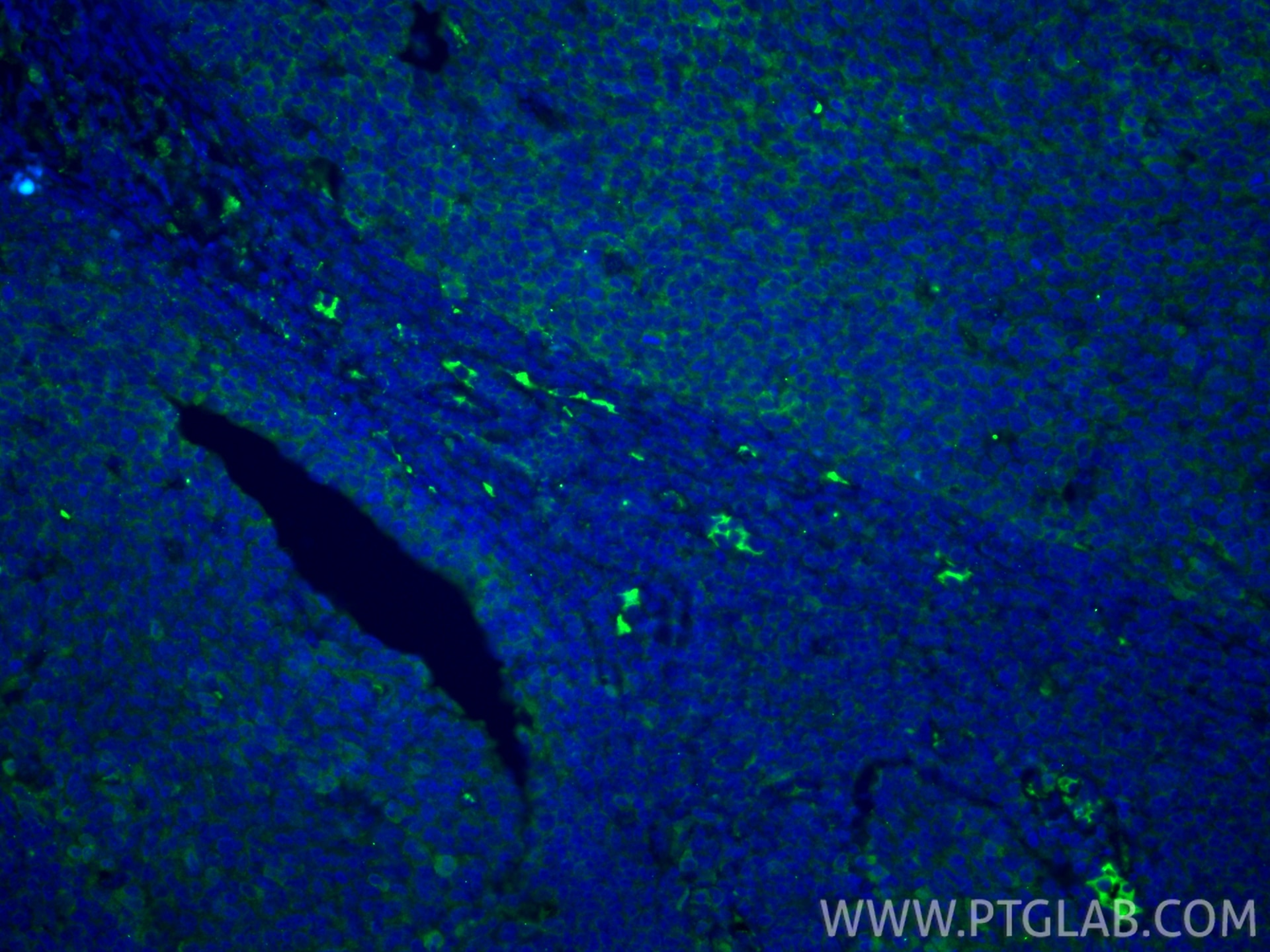 Immunofluorescence (IF) / fluorescent staining of human tonsillitis tissue using AID Polyclonal antibody (15642-1-AP)