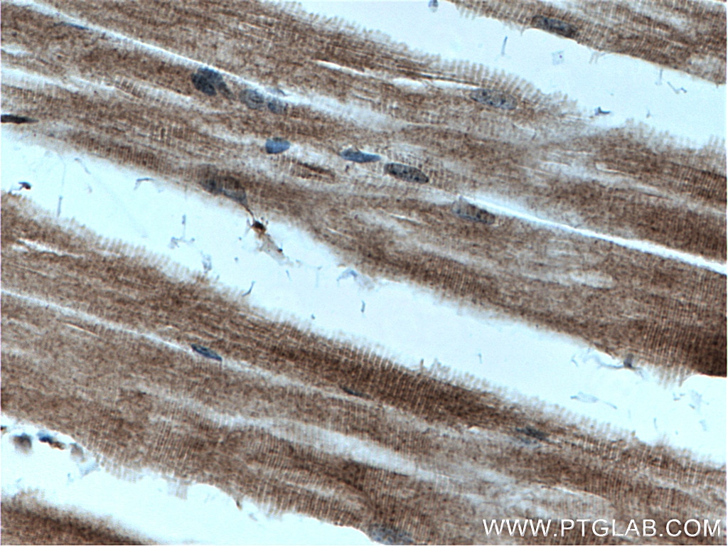 Immunohistochemistry (IHC) staining of mouse skeletal muscle tissue using AIDA Polyclonal antibody (23724-1-AP)