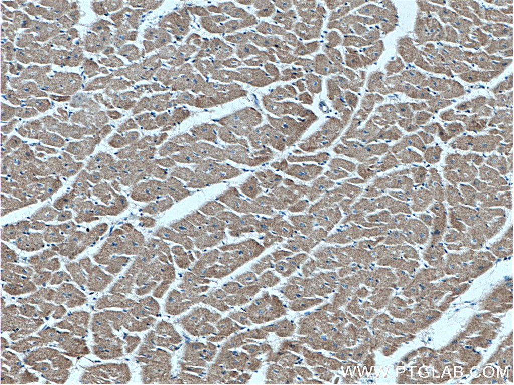 Immunohistochemistry (IHC) staining of human heart tissue using AIDA Polyclonal antibody (23724-1-AP)
