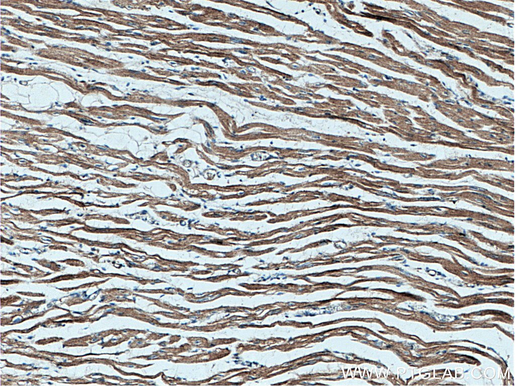 Immunohistochemistry (IHC) staining of human heart tissue using AIDA Polyclonal antibody (23724-1-AP)
