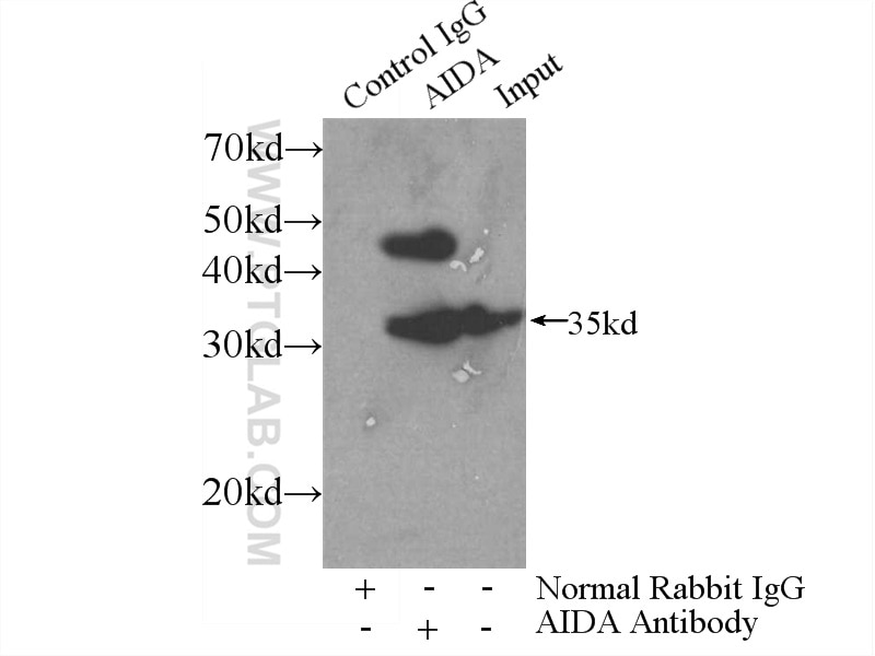 Immunoprecipitation (IP) experiment of HeLa cells using AIDA Polyclonal antibody (23724-1-AP)