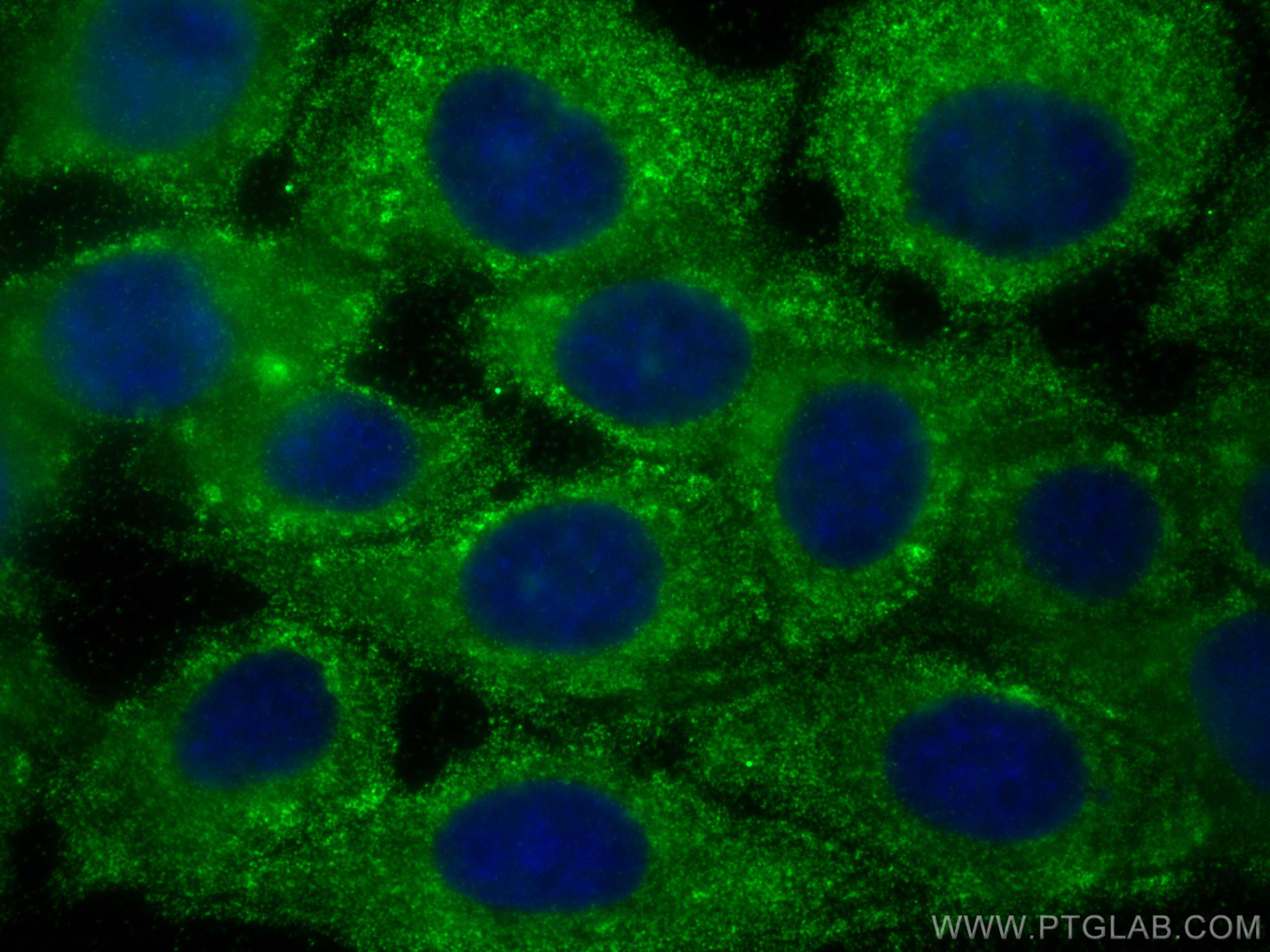 Immunofluorescence (IF) / fluorescent staining of A431 cells using AIDA Monoclonal antibody (68153-1-Ig)