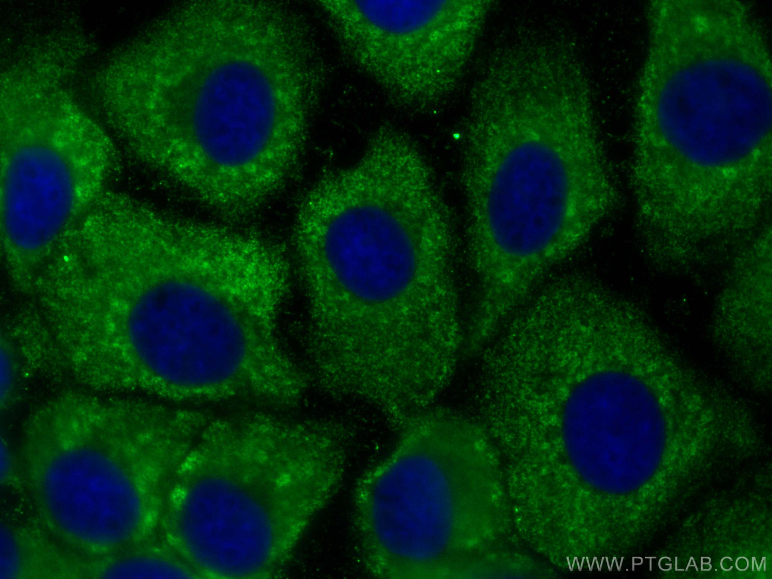 Immunofluorescence (IF) / fluorescent staining of A431 cells using CoraLite® Plus 488-conjugated AIDA Monoclonal anti (CL488-68153)