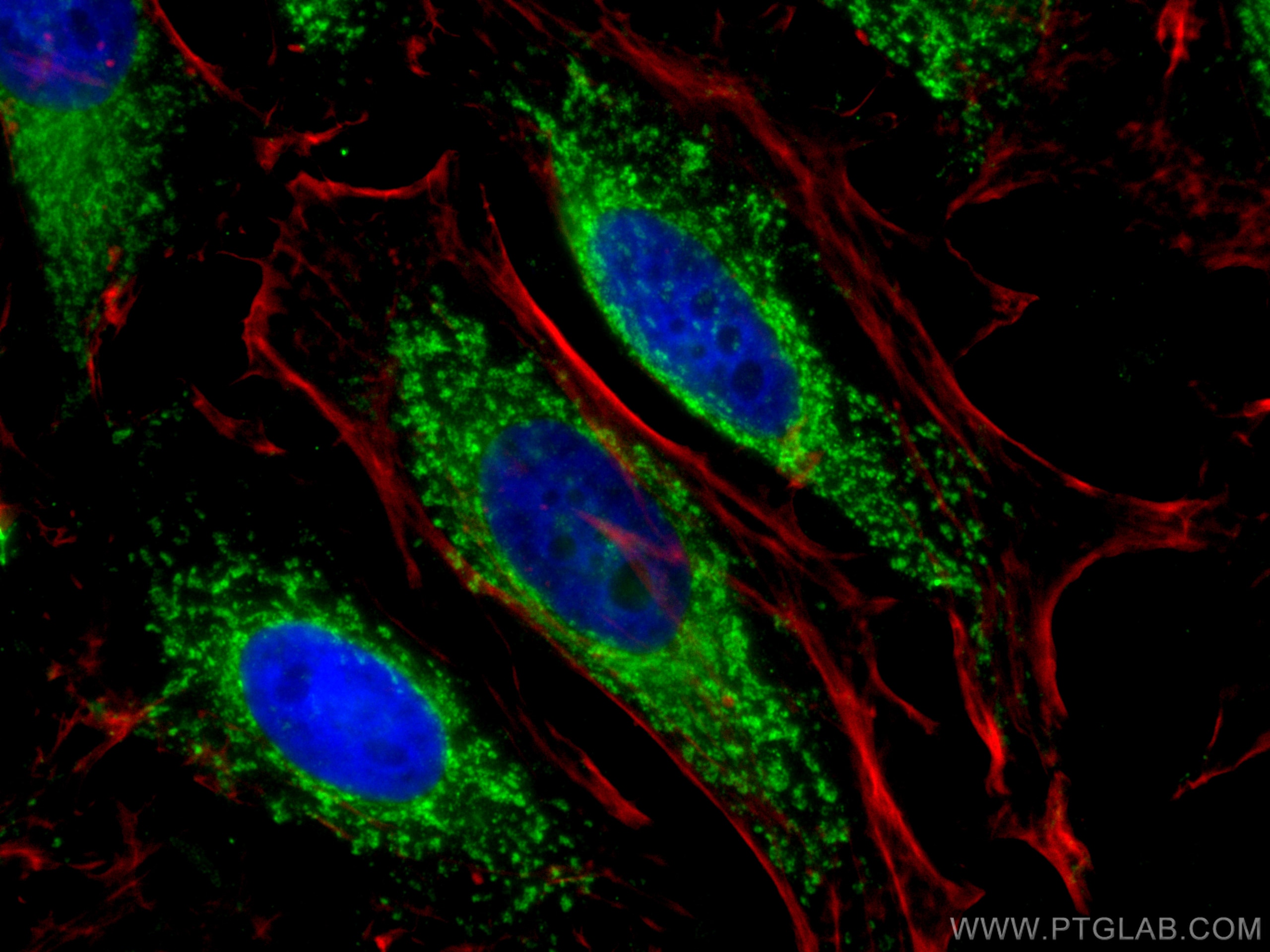 IF Staining of HeLa using 17984-1-AP