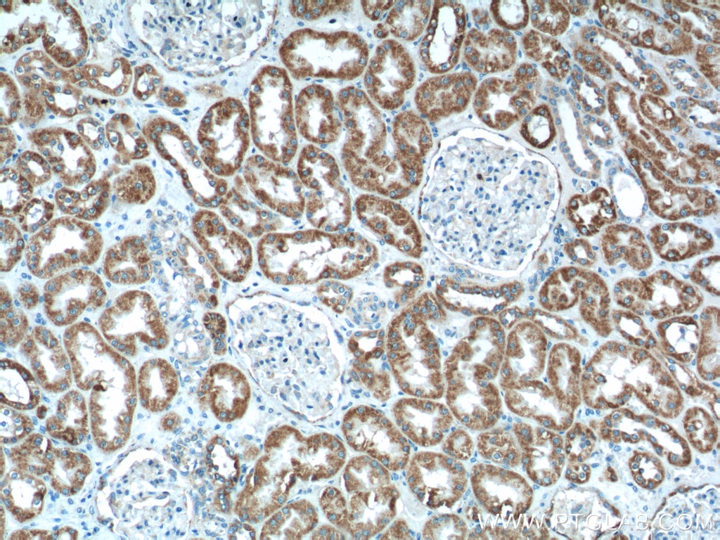 Immunohistochemistry (IHC) staining of human kidney tissue using AIF Polyclonal antibody (17984-1-AP)