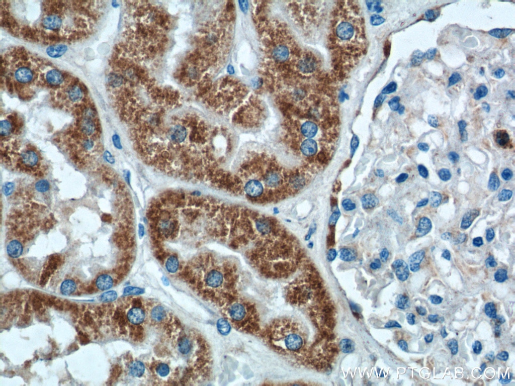 Immunohistochemistry (IHC) staining of human kidney tissue using AIF Polyclonal antibody (17984-1-AP)