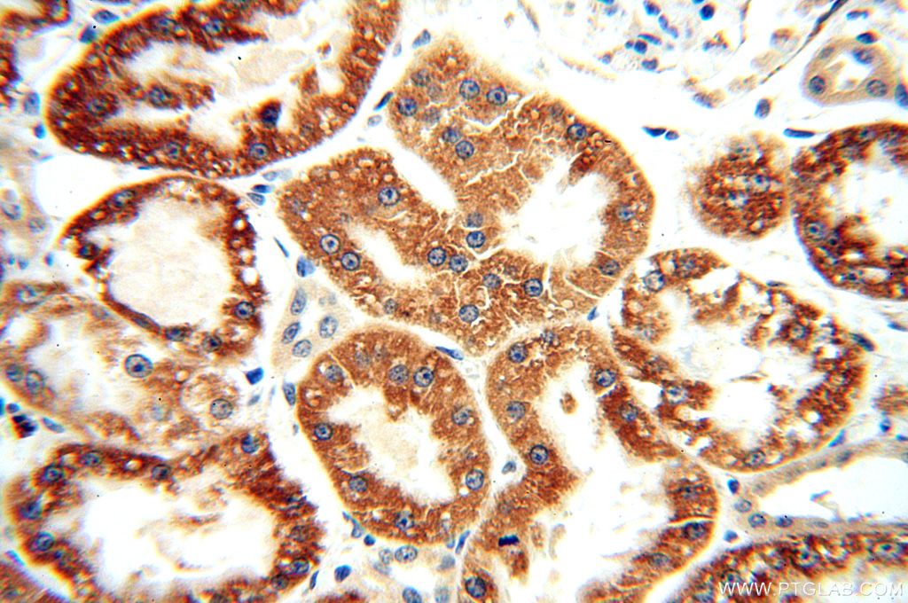 Immunohistochemistry (IHC) staining of human kidney tissue using AIF Polyclonal antibody (17984-1-AP)