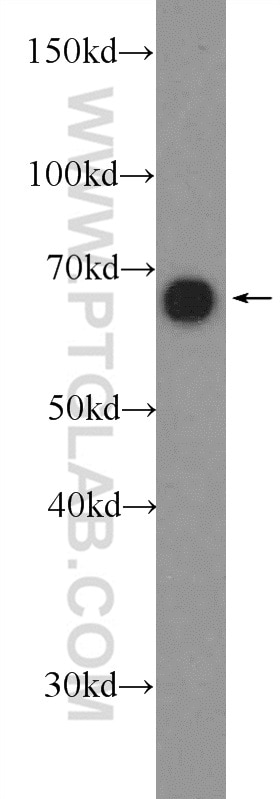 Western Blot (WB) analysis of rat kidney tissue using AIF Polyclonal antibody (17984-1-AP)