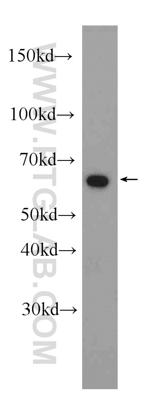 Western Blot (WB) analysis of HeLa cells using AIF Polyclonal antibody (17984-1-AP)