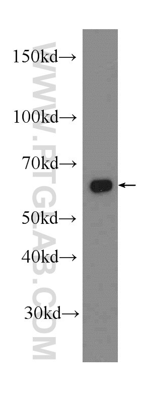 Western Blot (WB) analysis of Jurkat cells using AIF Polyclonal antibody (17984-1-AP)