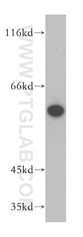 Western Blot (WB) analysis of A549 cells using AIF Polyclonal antibody (17984-1-AP)