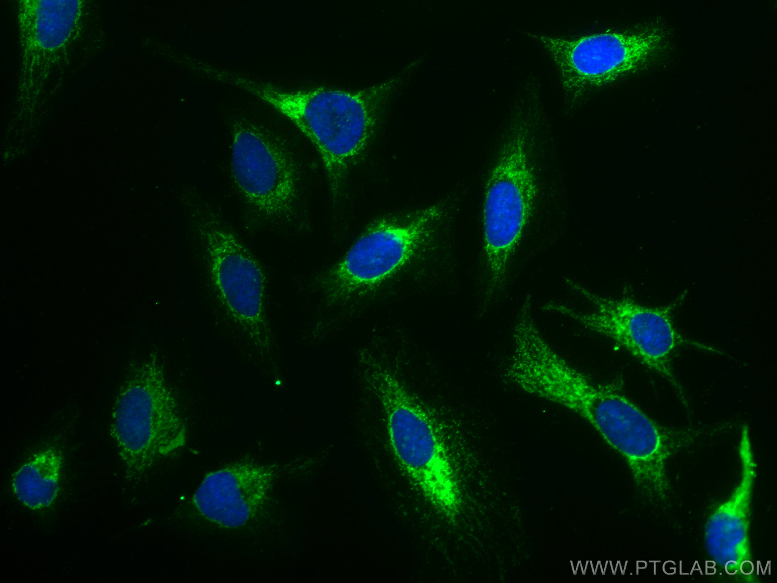 Immunofluorescence (IF) / fluorescent staining of HeLa cells using AIF Monoclonal antibody (67791-1-Ig)