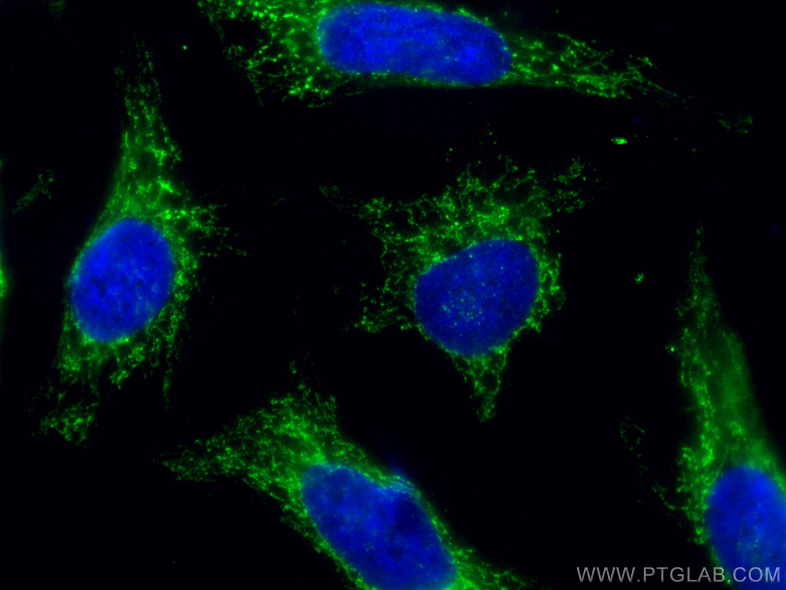 Immunofluorescence (IF) / fluorescent staining of HeLa cells using AIF Monoclonal antibody (67791-1-Ig)