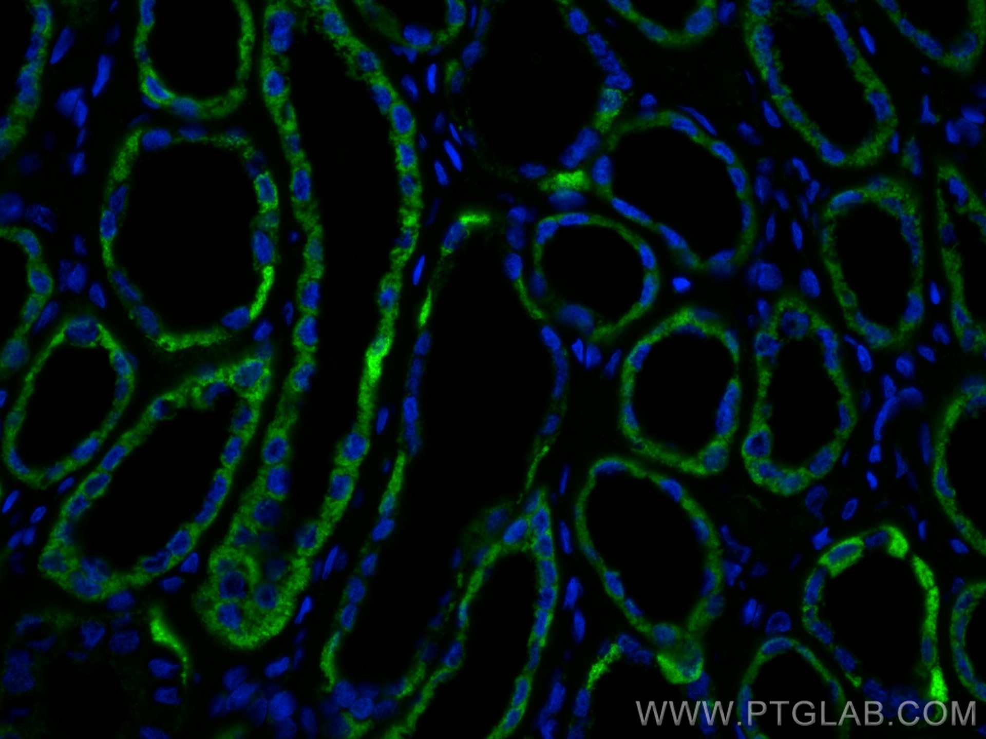 Immunofluorescence (IF) / fluorescent staining of human kidney tissue using AIF Monoclonal antibody (67791-1-Ig)