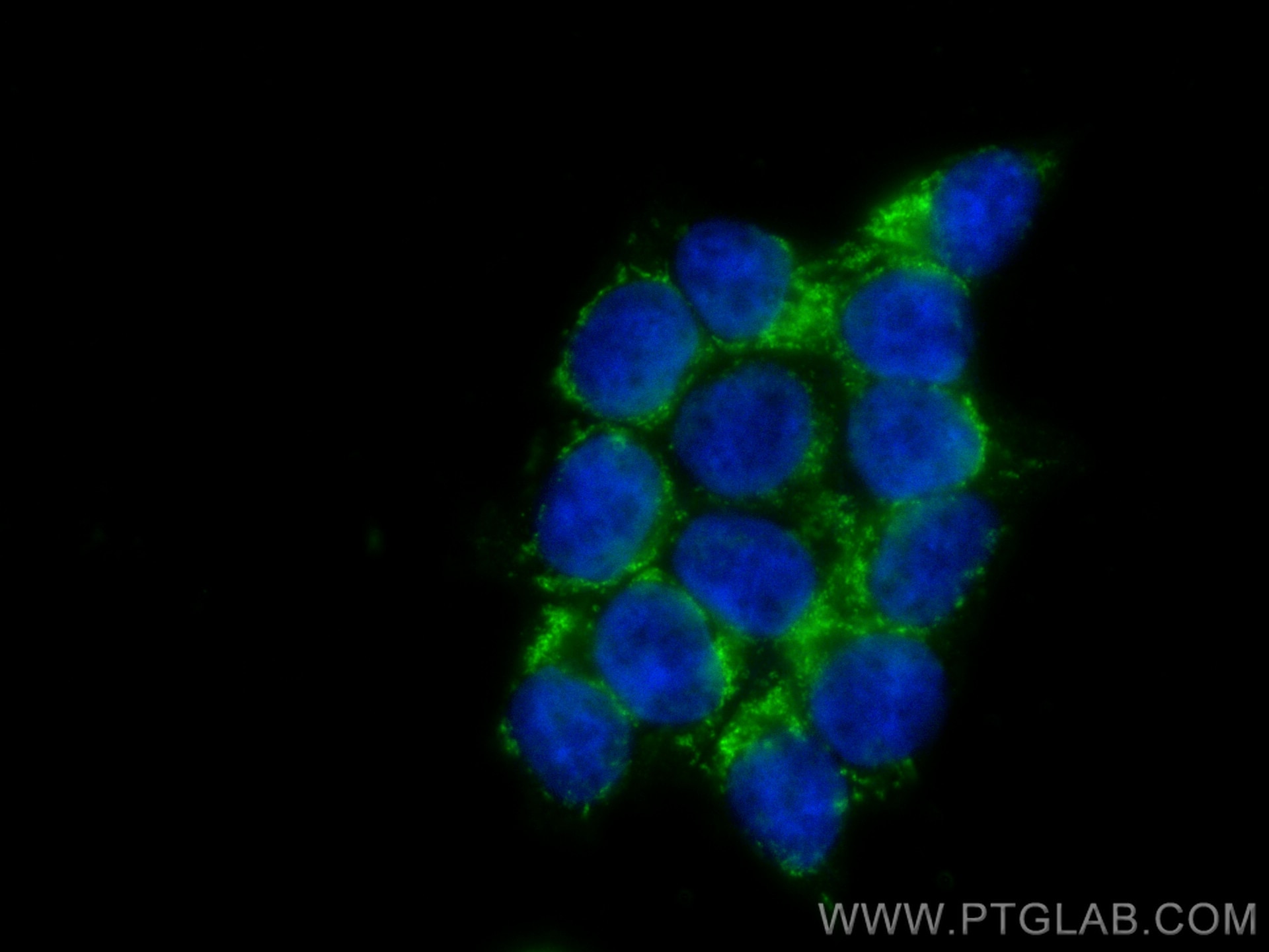 Immunofluorescence (IF) / fluorescent staining of HCT 116 cells using AIF Monoclonal antibody (67791-1-Ig)
