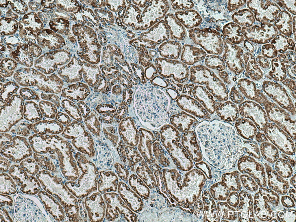 Immunohistochemistry (IHC) staining of human kidney tissue using AIF Monoclonal antibody (67791-1-Ig)