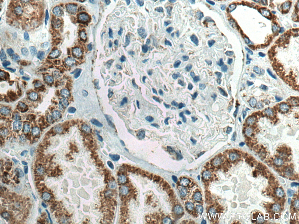 Immunohistochemistry (IHC) staining of human kidney tissue using AIF Monoclonal antibody (67791-1-Ig)