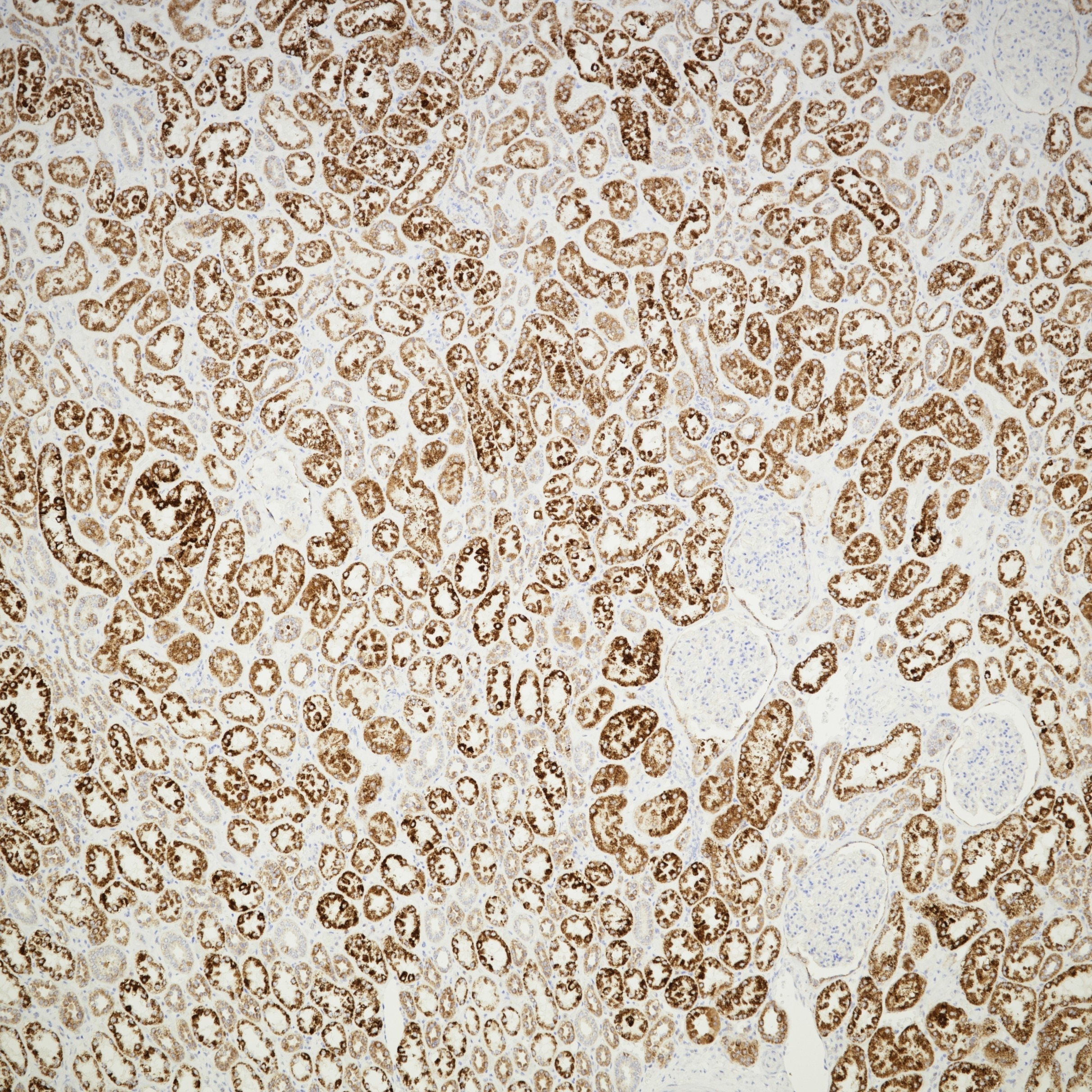 Immunohistochemistry (IHC) staining of human kidney tissue using AIF Monoclonal antibody (67791-1-Ig)
