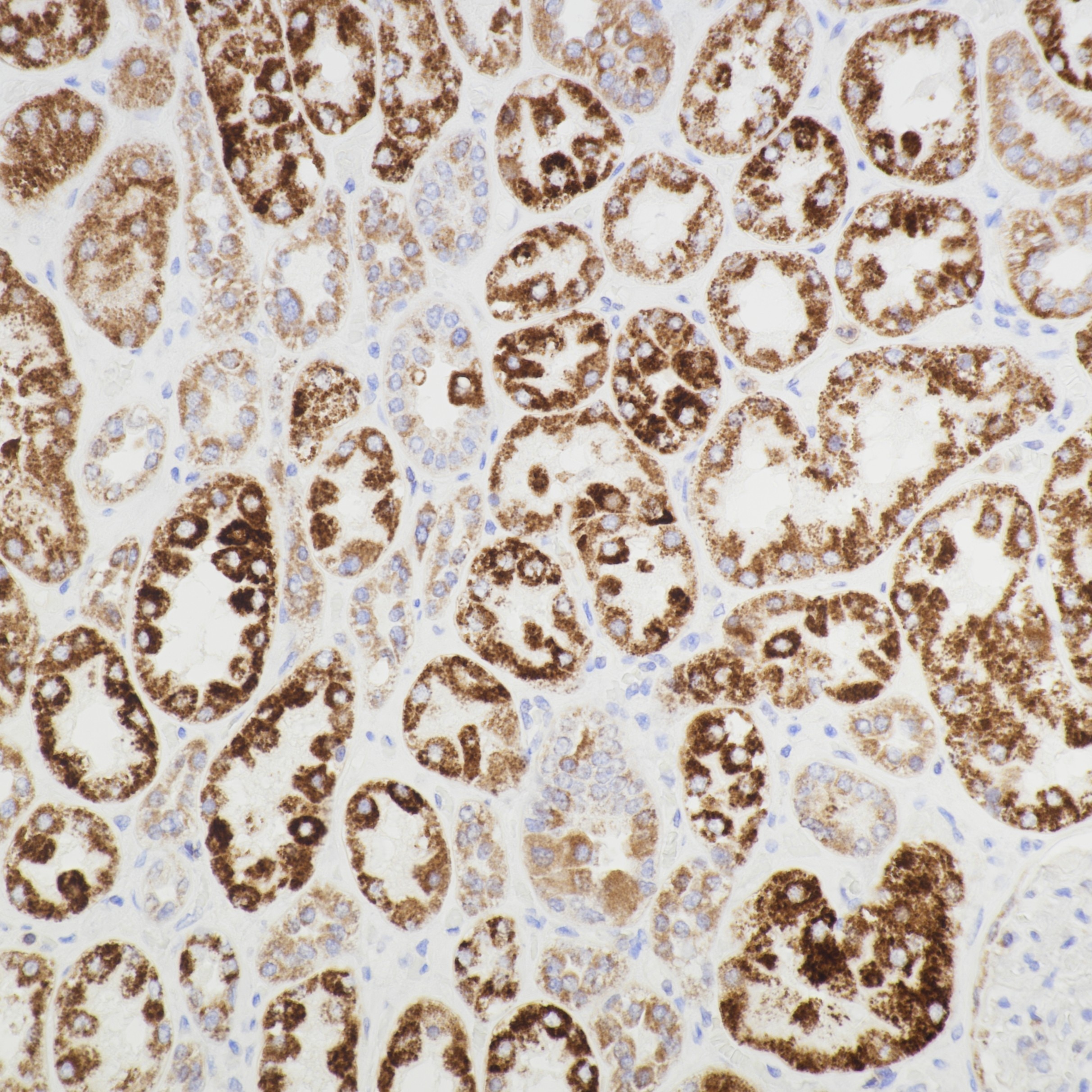 Immunohistochemistry (IHC) staining of human kidney tissue using AIF Monoclonal antibody (67791-1-Ig)