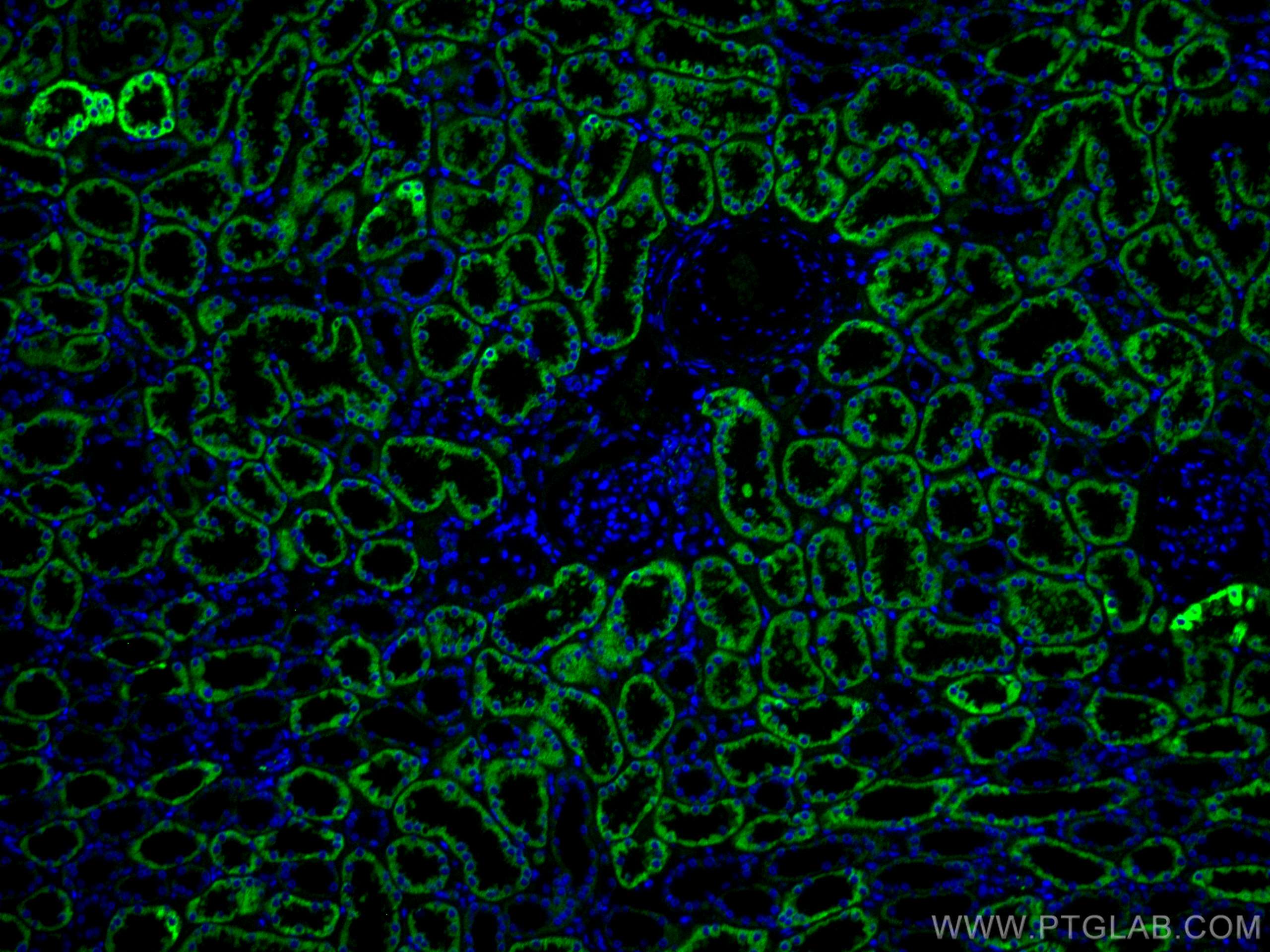 Immunofluorescence (IF) / fluorescent staining of human kidney tissue using CoraLite® Plus 488-conjugated AIF Monoclonal antib (CL488-67791)