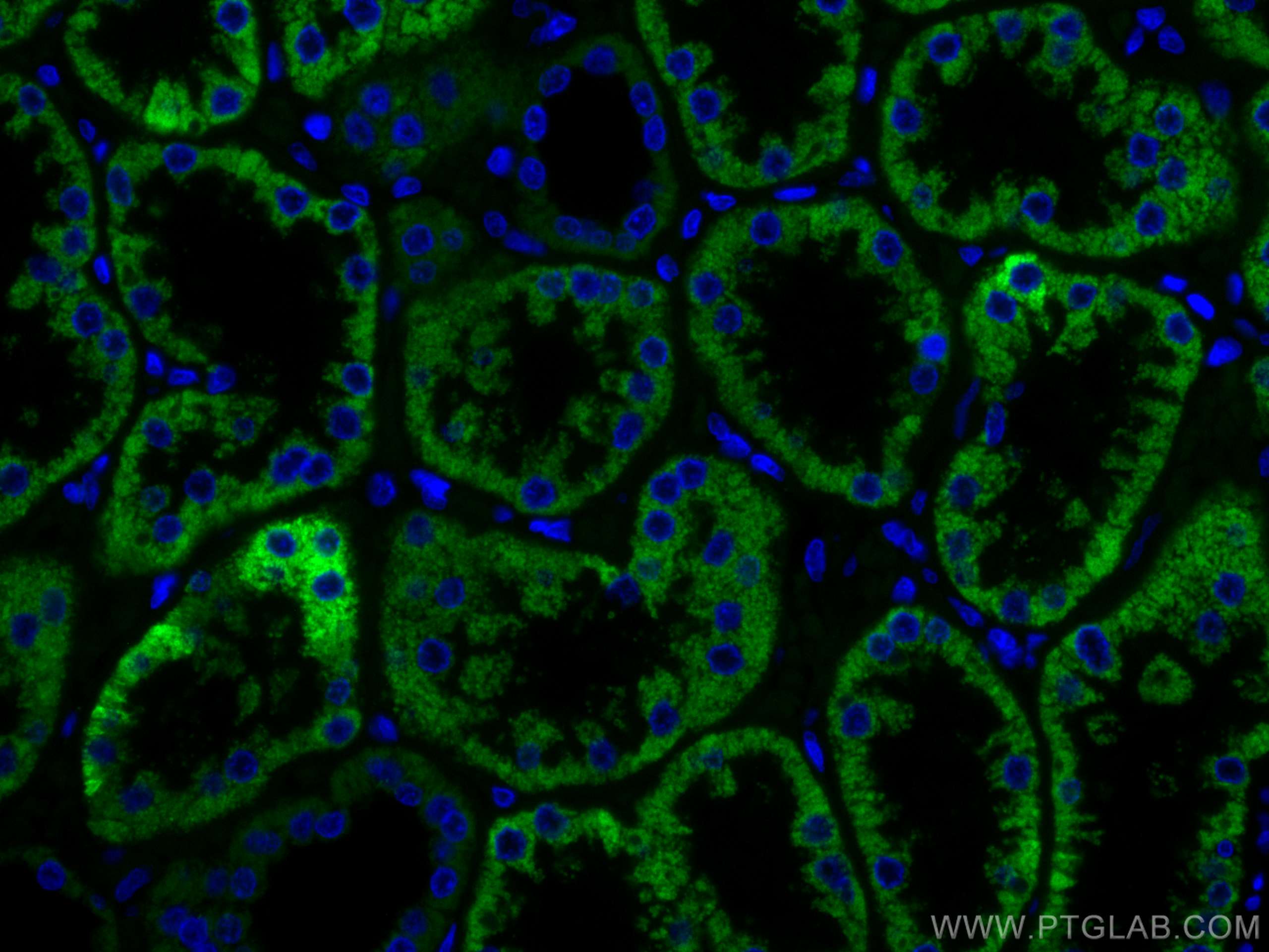 Immunofluorescence (IF) / fluorescent staining of human kidney tissue using CoraLite® Plus 488-conjugated AIF Monoclonal antib (CL488-67791)