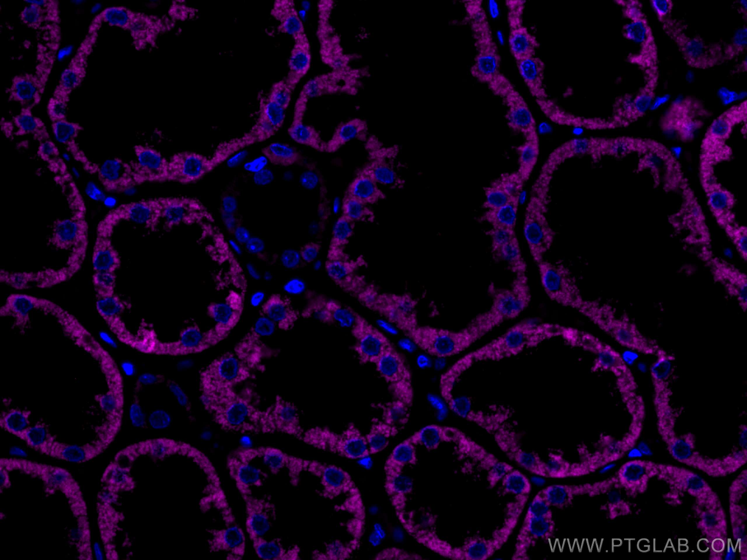 Immunofluorescence (IF) / fluorescent staining of human kidney tissue using CoraLite® Plus 647-conjugated AIF Monoclonal antib (CL647-67791)