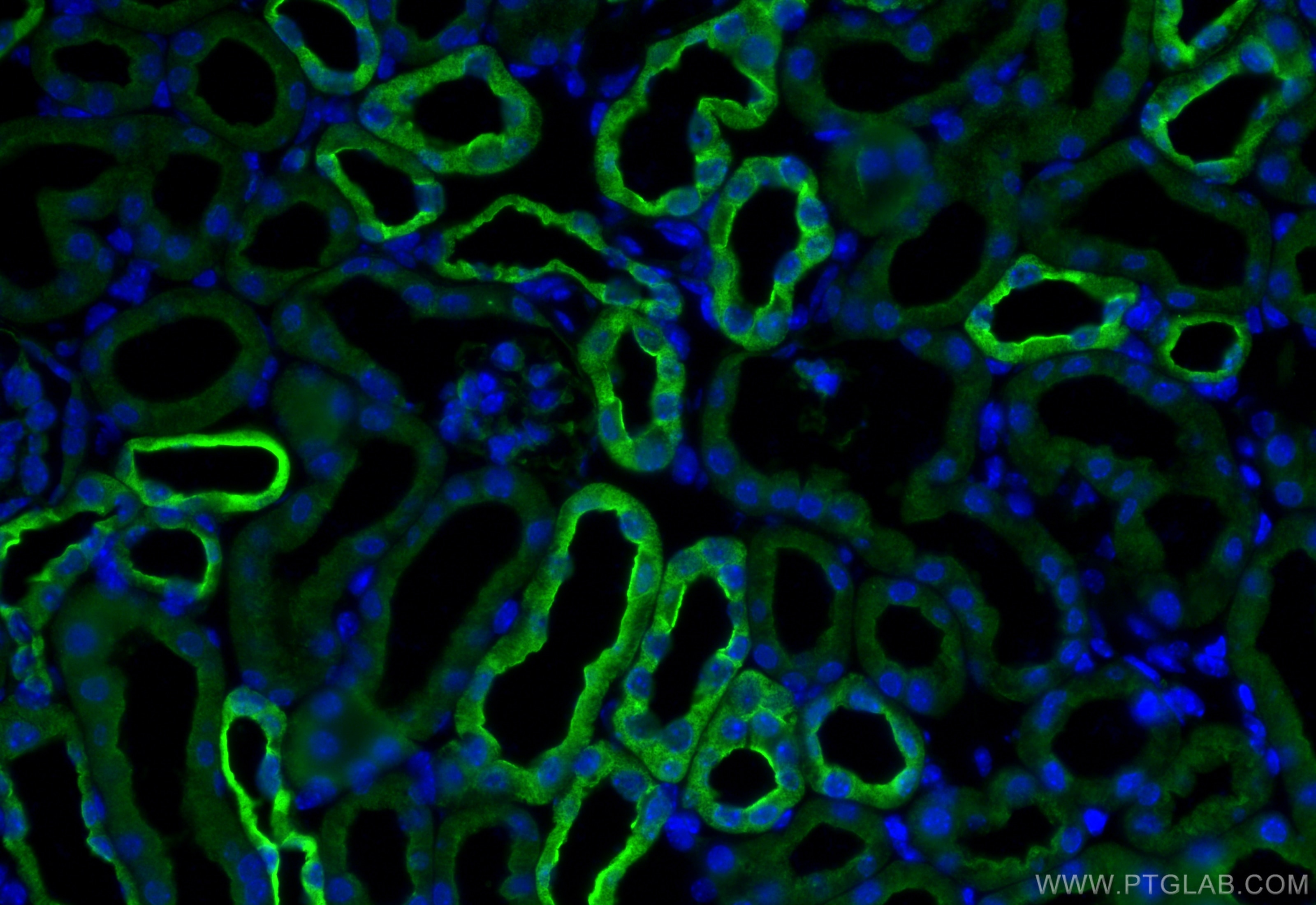 Immunofluorescence (IF) / fluorescent staining of mouse kidney tissue using AIF1L Polyclonal antibody (31569-1-AP)