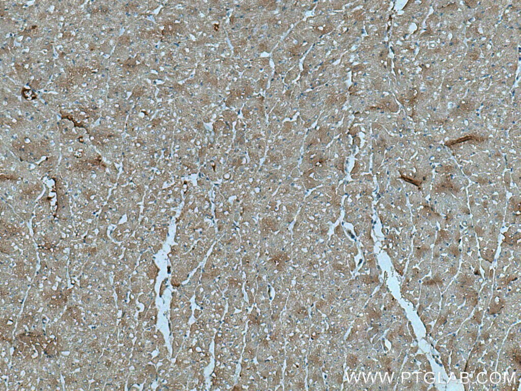 IHC staining of human heart using 20886-1-AP