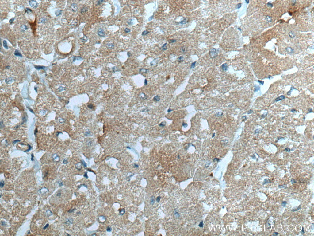 Immunohistochemistry (IHC) staining of human heart tissue using AIFM2/ FSP1 Polyclonal antibody (20886-1-AP)