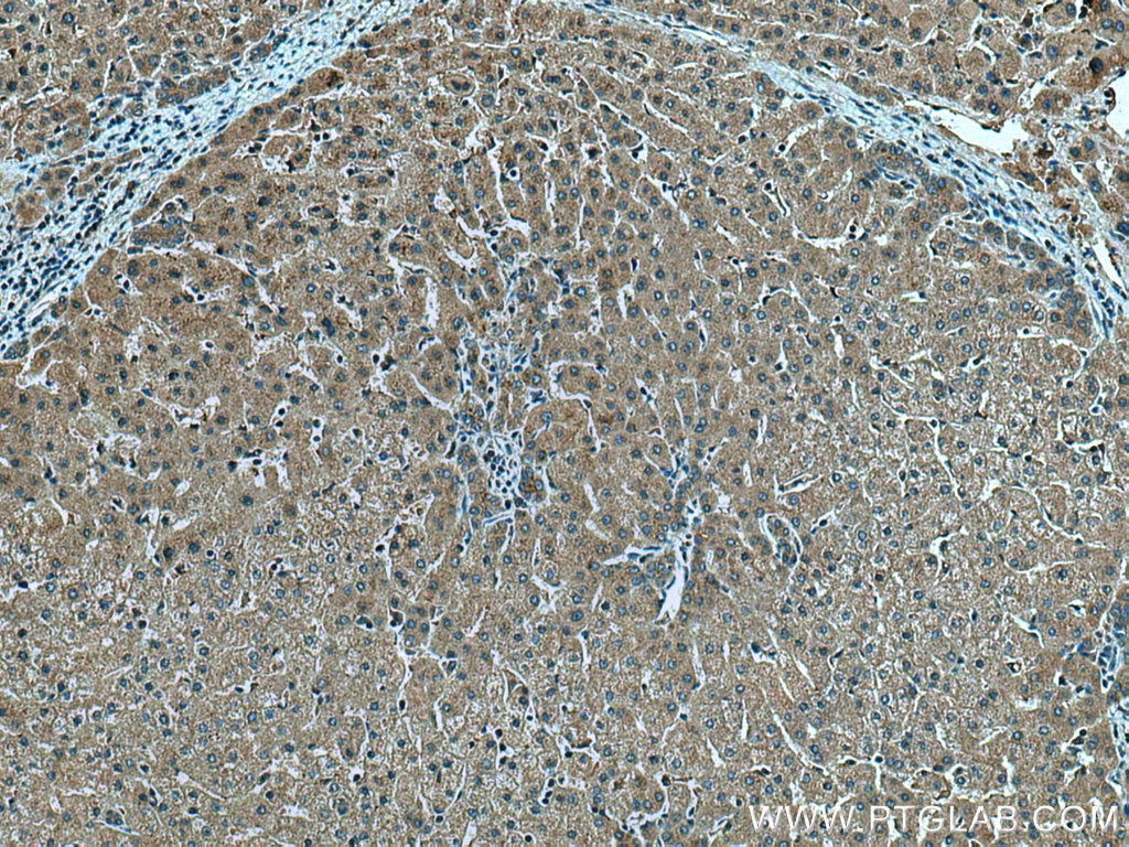Immunohistochemistry (IHC) staining of human liver tissue using AIFM2/ FSP1 Polyclonal antibody (20886-1-AP)