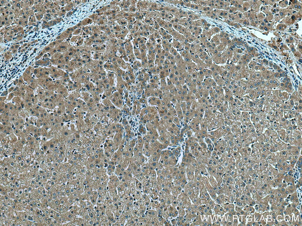 Immunohistochemistry (IHC) staining of human liver tissue using AIFM2/ FSP1 Polyclonal antibody (20886-1-AP)
