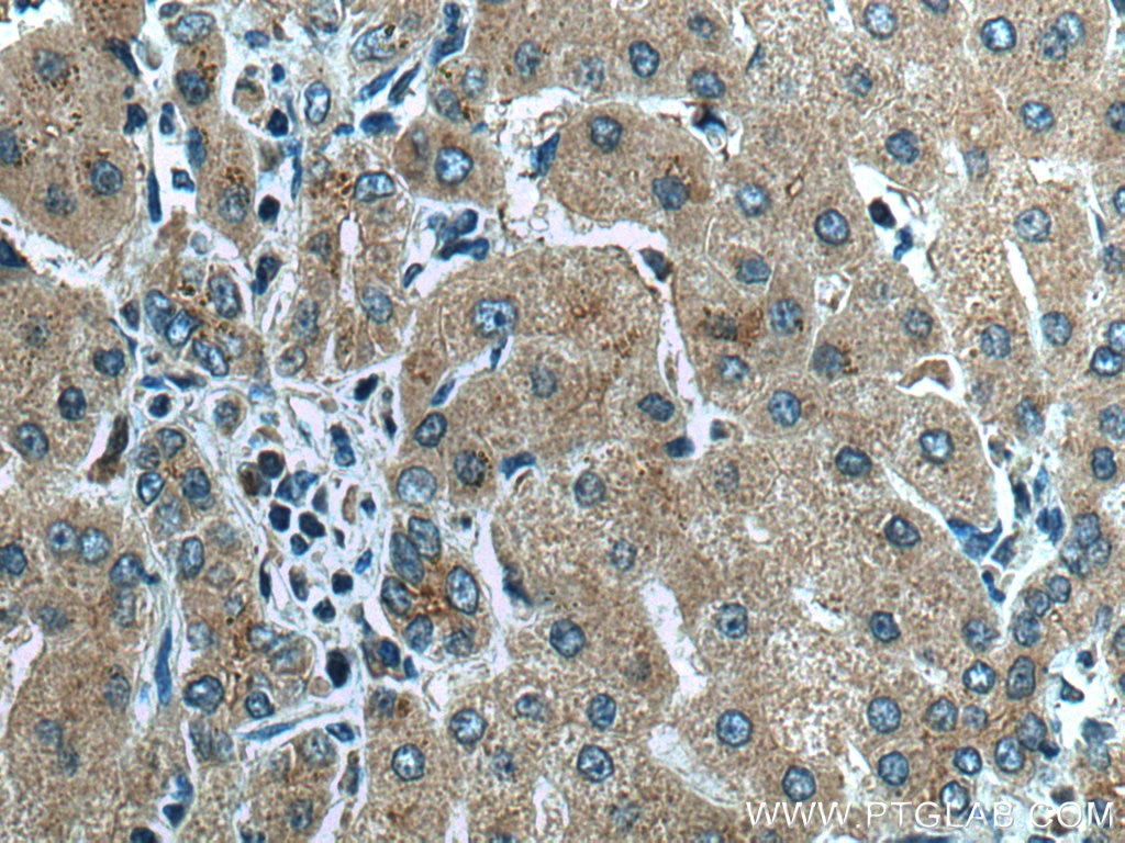 Immunohistochemistry (IHC) staining of human liver tissue using AIFM2/ FSP1 Polyclonal antibody (20886-1-AP)