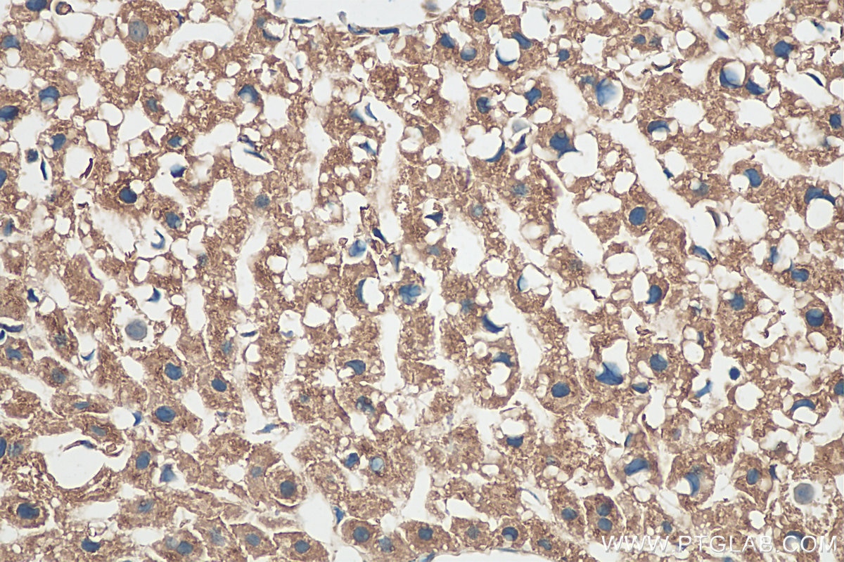 Immunohistochemistry (IHC) staining of mouse liver tissue using AIFM2/ FSP1 Polyclonal antibody (20886-1-AP)