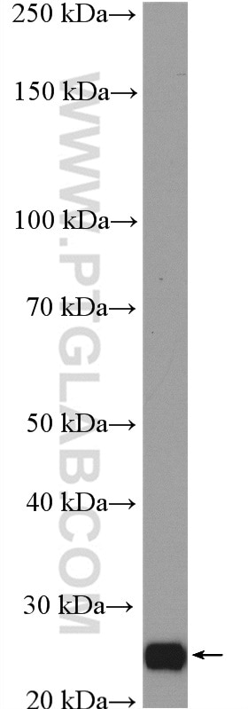 Western Blot (WB) analysis of rat ovary tissue using AIG1 Polyclonal antibody (14468-1-AP)