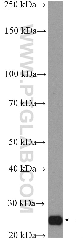 WB analysis of rat ovary using 14468-1-AP