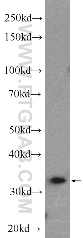 WB analysis of PC-3 using 14468-1-AP