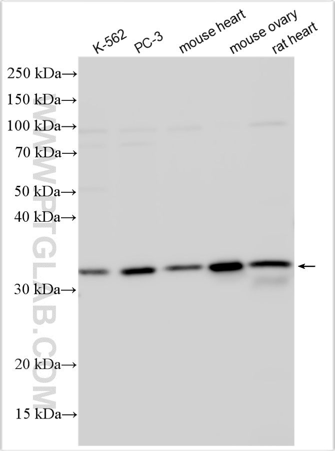 Western Blot (WB) analysis of various lysates using AIG1 Polyclonal antibody (14468-1-AP)