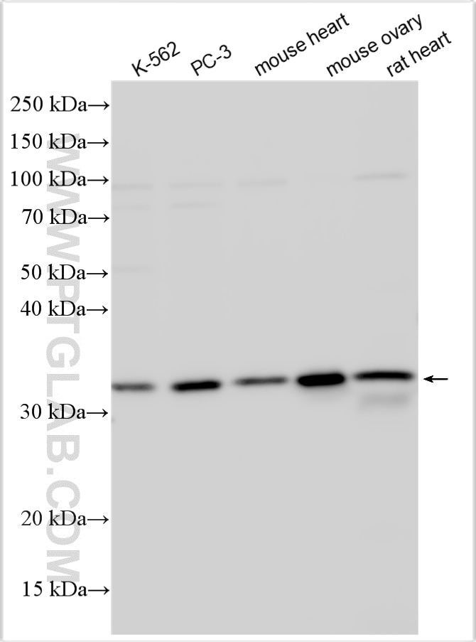 Western Blot (WB) analysis of various lysates using AIG1 Polyclonal antibody (14468-1-AP)