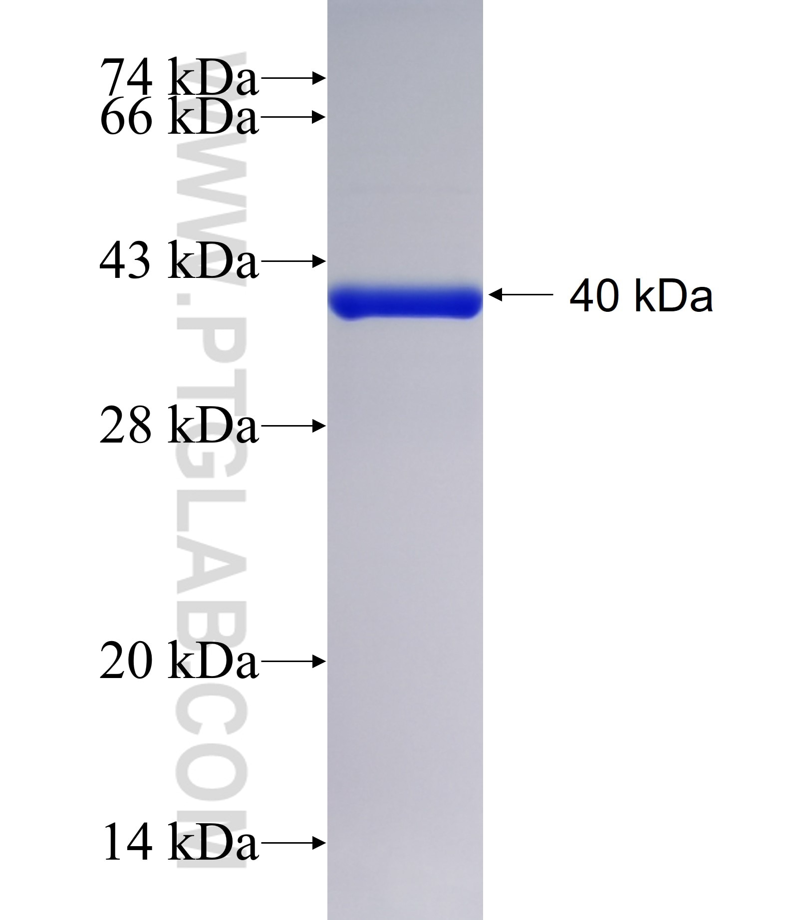 AIM1 fusion protein Ag39868 SDS-PAGE