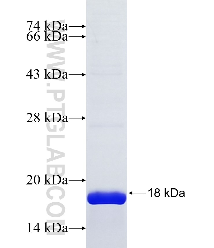 AIM1 fusion protein Ag39883 SDS-PAGE AIM1 fusion protein Ag39883 SDS-PAGE