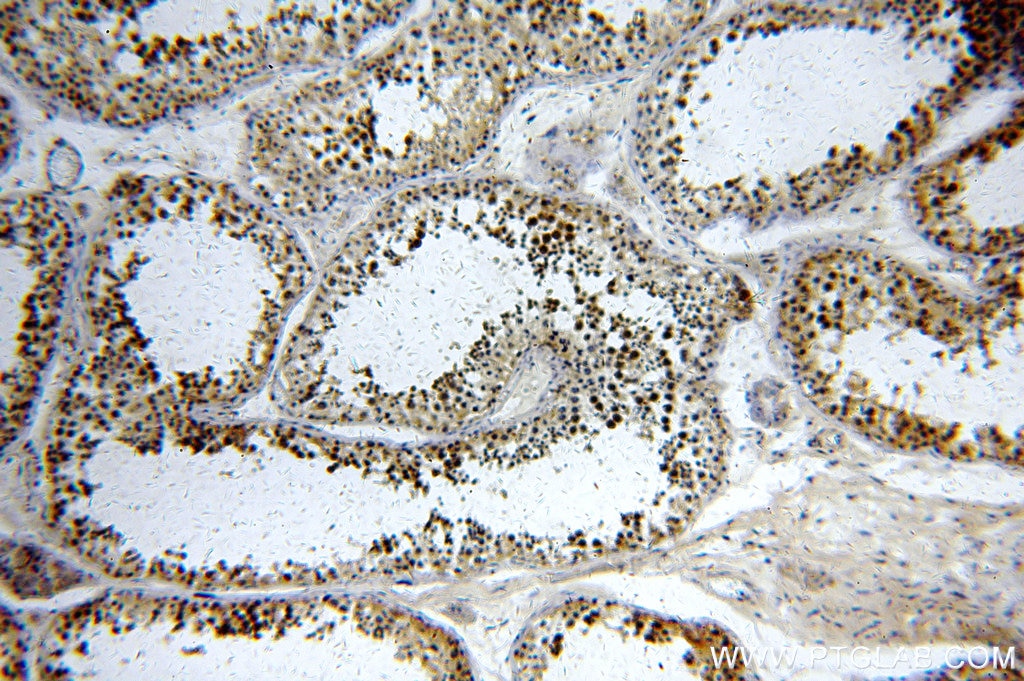 Immunohistochemistry (IHC) staining of human testis tissue using AIM2 Polyclonal antibody (20590-1-AP)