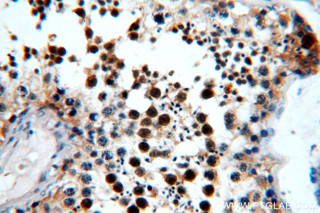 Immunohistochemistry (IHC) staining of human testis tissue using AIM2 Polyclonal antibody (20590-1-AP)