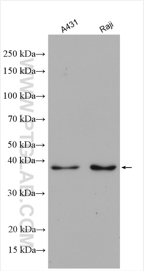 Western Blot (WB) analysis of various lysates using AIM2 Polyclonal antibody (20590-1-AP)