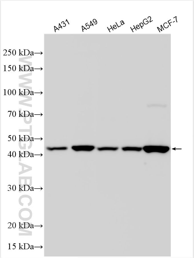 Western Blot (WB) analysis of various lysates using AIM2 Polyclonal antibody (20590-1-AP)