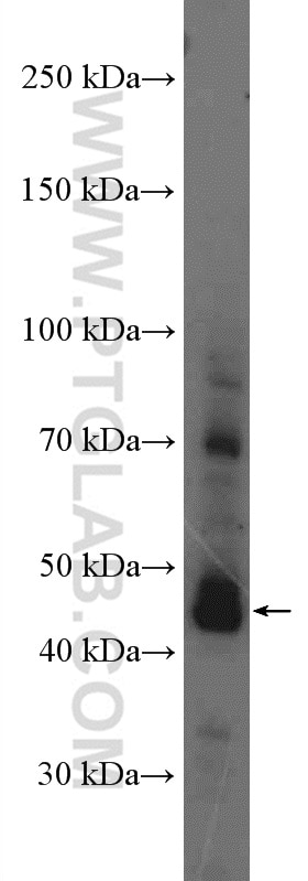 Western Blot (WB) analysis of mouse testis tissue using AIM2 Polyclonal antibody (20590-1-AP)