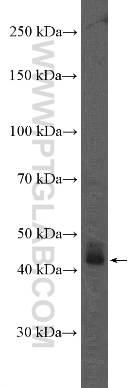 Western Blot (WB) analysis of rat testis tissue using AIM2 Polyclonal antibody (20590-1-AP)