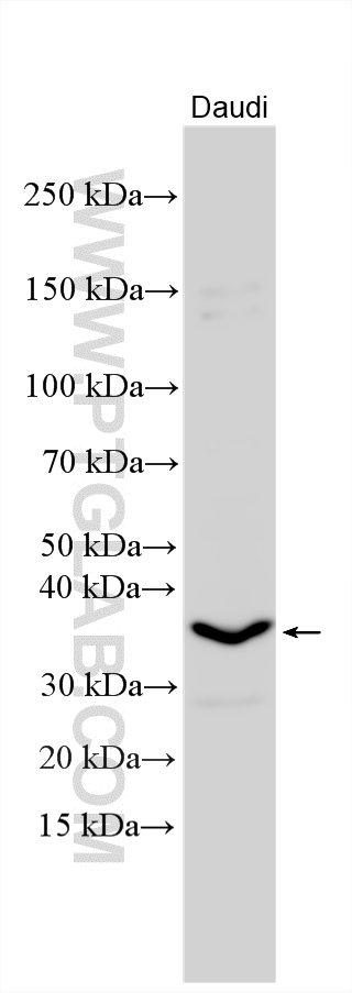 WB analysis using 20590-1-AP Western Blot (WB) analysis of various lysates using AIM2 Polyclonal antibody (20590-1-AP)